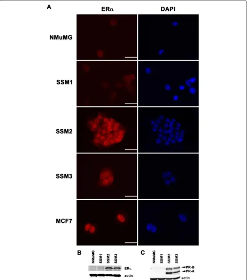 Figure 5 STAT1blot analysis. NMuMG exhibited no detectable levels of ERnot display functional ERSSM3 expressed nuclear ERERpromoters and are target genes for ER-/- mammary tumor cell lines SSM2 and SSM3 express estrogen receptor-alpha (ERa), PR-A, and PR-B