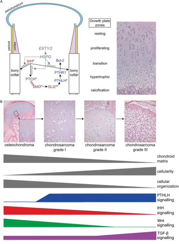 Figure 1. Schematic representations of signalling pathways in growth plate, osteochondromas, and chondrosarcomas.