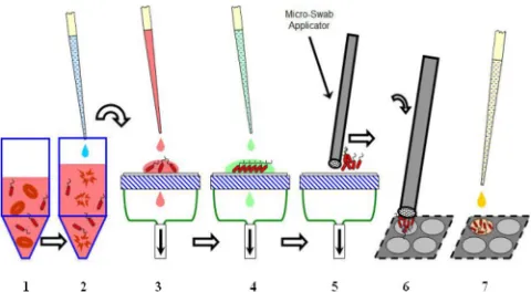 FIG 2 Manifold used for processing of blood culture samples. Three separatevalves with attached ﬁlters allow simultaneous processing of three samples.The manifold is attached to a vacuum source via a vesicle to store waste and isoperated under a biological safety hood.