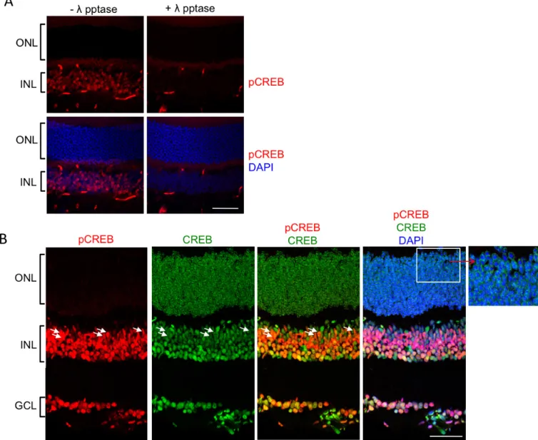 Figure 2. Expression and localization of CREB and pCREB in the wild-type retina at P28