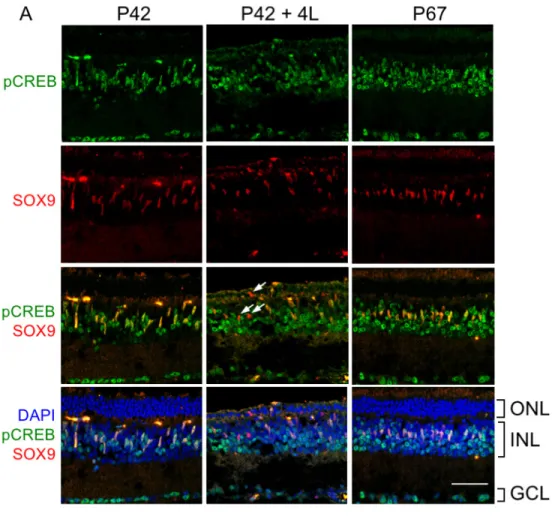 Figure 5. rd10 retinas from dark- dark-reared mice undergo slower  degen-eration compared with retinas from  cyclic light-reared mice