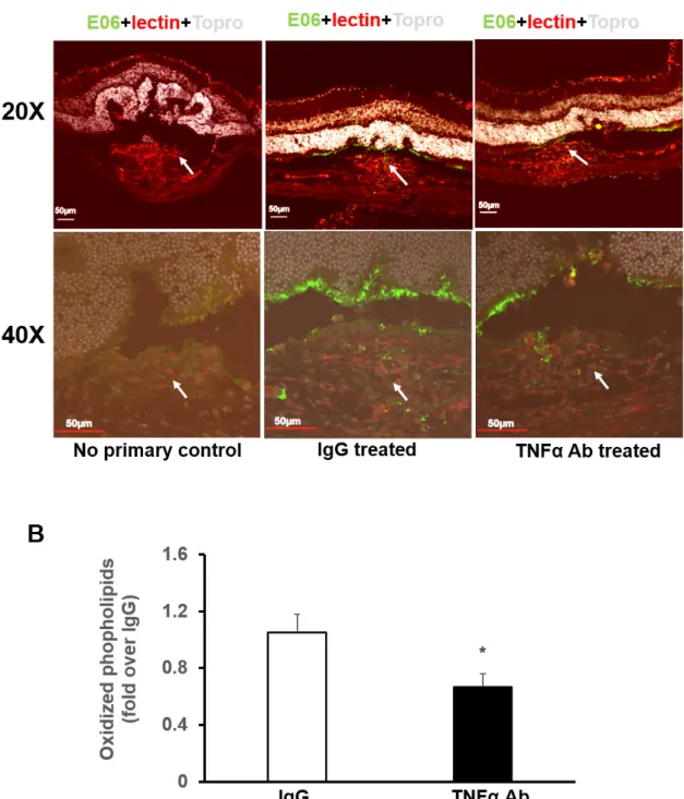 Figure 2. TNF-α induces ROS generation within multiple cell types within CNV lesions. A: Immunostaining for oxidized phospholipids  (OxPLs) in retinal/choroidal cryosections