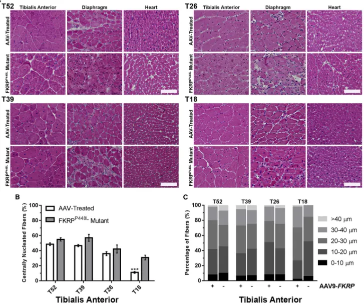 Figure 2. FKRP Gene Therapy Improves the Internal Structure and Hyper-/Hypotrophy of Skeletal and Cardiac Muscle Fibers