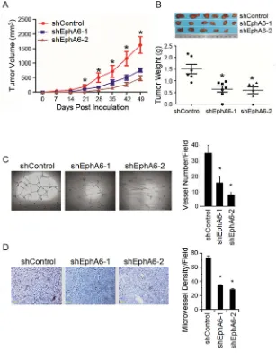 Figure 3: Knock-down of EphA6 decreases tumor angiogenesis. A. Subcutaneous xenograft CaP models were generated using PC-3M/shEphA6-1, PC-3M/shEphA6-2 or PC-3M/shControl cells