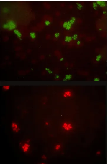 FIG 1 QFT. (Top) green ﬂuorescence of Staphylococcus aureus; (bottom) red ﬂuorescence of a Staphylococcus epidermidis strain.