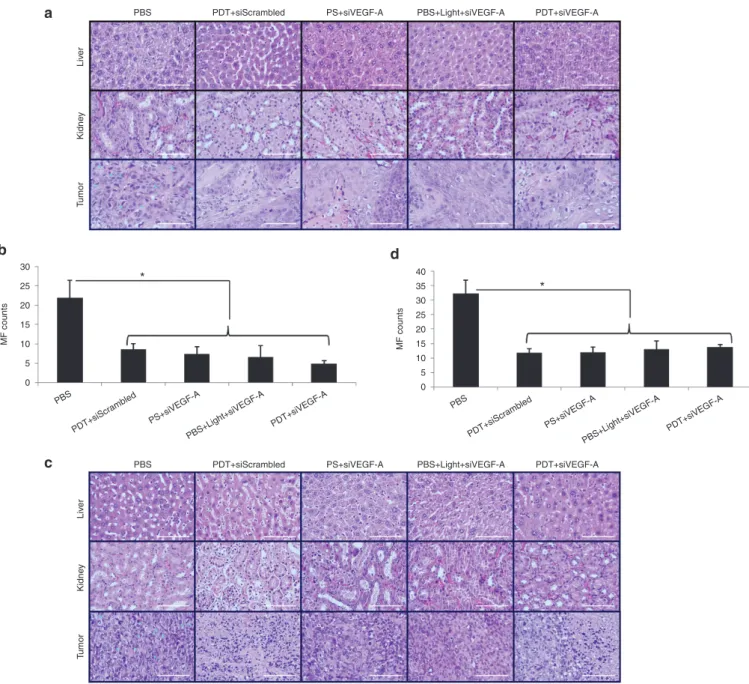 Figure 5 H&amp;E staining of liver, kidney, and tumor tissue sections of HNSCC xenograft models