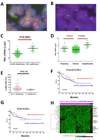 Figure 5: REL amplification analysis in DBLCL. A–B. Representative DLBCL cases positive or negative for REL amplification by fluorescence in situ hybridization analysis