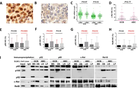 Figure 1: Nuclear expression of c-Rel and other NF-κB subunits. A-B. Representative immunohistochemical staining for positive and negative nuclear c-Rel expression
