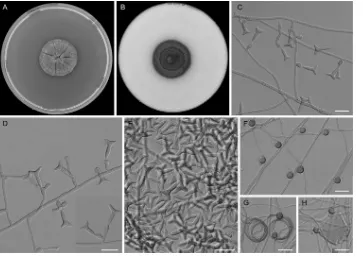 TABLE 3 Results of in vitro antifungal susceptibility testing of the 16 clinical isolates of Ochroconis spp