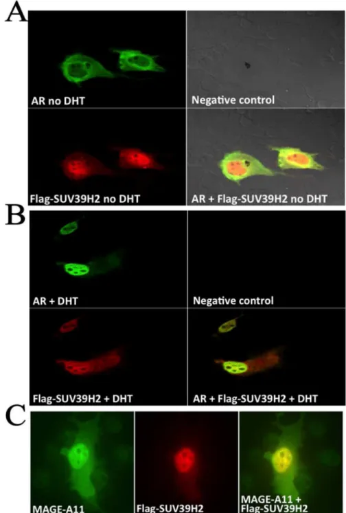 Figure 6. SUV39H2 colocalizes with AR and MAGE-A11