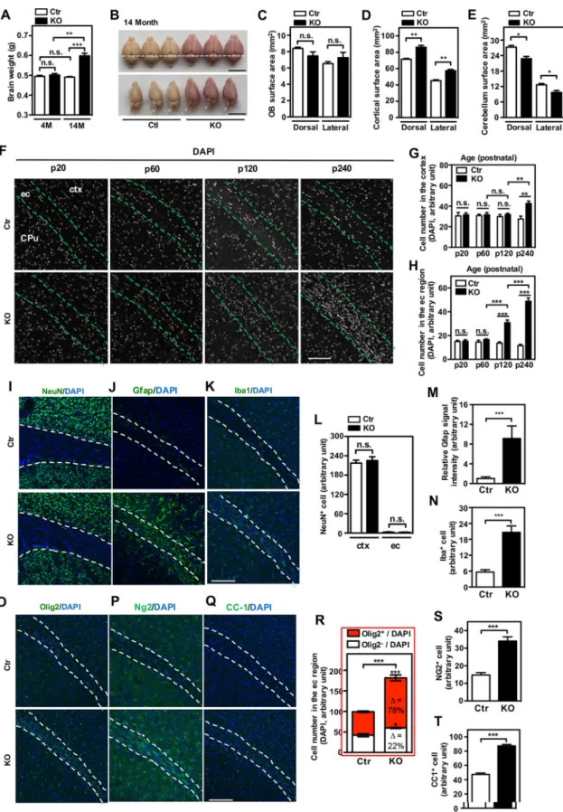 FIG 4 Deletion of L2hgdh increases glial cells and brain mass. (A) L2hgdh KO mice show increased brain weight at 14 months but not 4 months compared to their wild-type controls