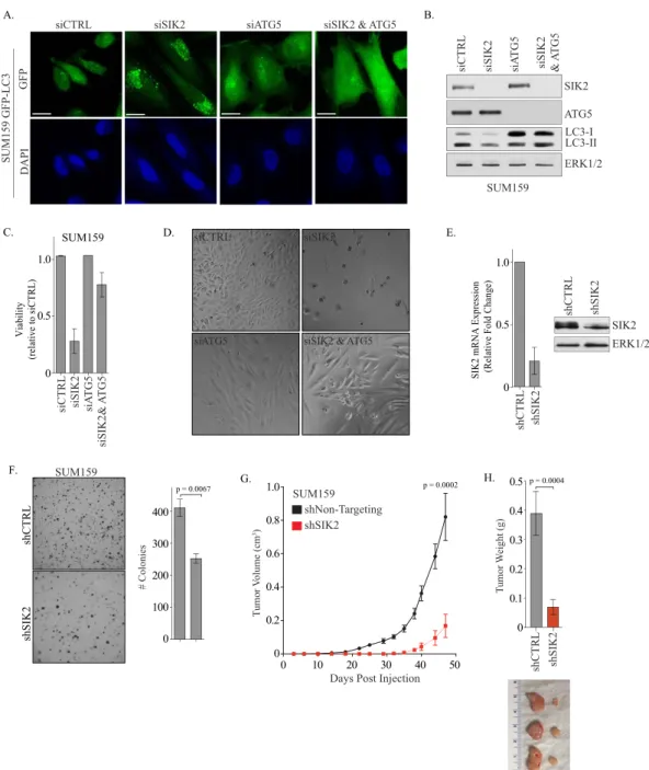 FIG 4 SIK2 restricts autophagy to support TNBC viability. (A) SUM159-GFP-LC3 cells were transfected with the indicated siRNAs for 72 h and exposed to 50