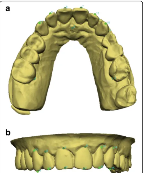 Fig. 1 Torque measurement using VAM software. Reference landmarksand points defining the labial FACC of the anterior teeth werelocalised on every digital model