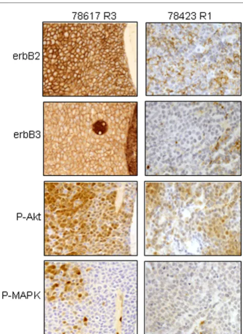 Figure 2and no staining for P-MAPK was observed (Fig. 2, right panel).The histological, cytological and biological features of these