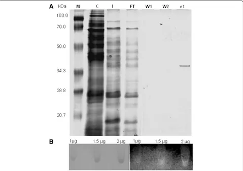 Figure 2 SDS- page, native- page and zymogram of the purified rHhMan. A) SDS-PAGE. M: Broad Range weight marker, C: Negative controlfor expression, I: Unpurified samples