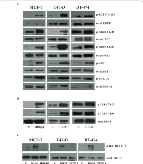 Figure 1 Western blot analysis. (a) Phosphorylated and total epidermal growth factor receptor (EGFR), erbB2, erbB3, Akt and extracellular-signal regulated kinase 1/2 (ERK1/2) and (b) phosphorylated and total insulin receptor substrate 1 (IRS-1) protein exp