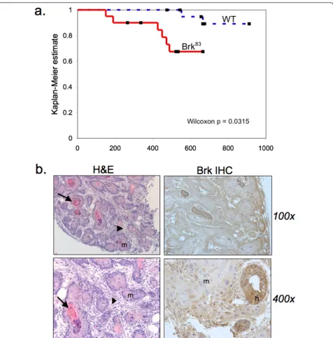 Figure 8 WAP-Brk mice develop mammary tumorsdays).. A, Kaplan-Meier estimate for the tumor cohort desribed in Table 1 (tumor free mice vs