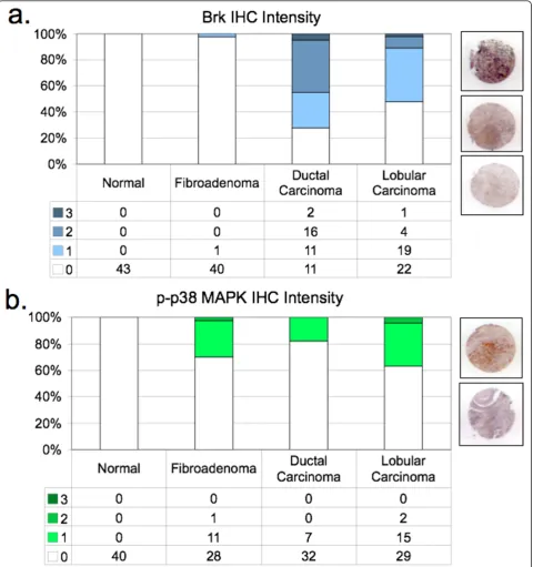 Table 2 Brk co-expression with p-p38 MAPK in human TMA samples