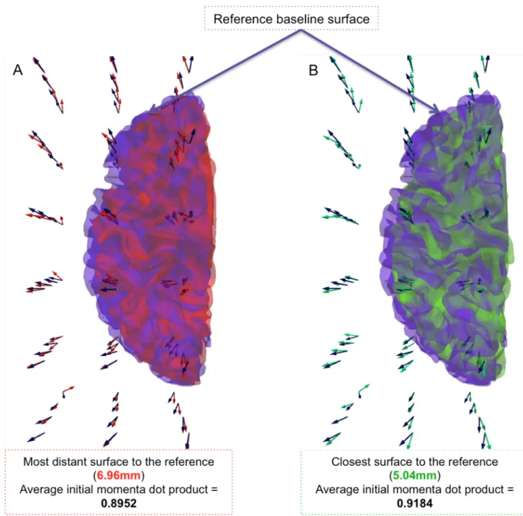 Figure 3. Geometrically similar baseline infant cortical surfaces have a similar dynamic  evolution