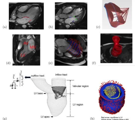Fig. 1. The CMR-derived MV–LV model. (a) The MV leaﬂets were segmented from a stack of MR images of a volunteer at early-diastole, (b) positions of the papillary muscle  heads and the annulus ring, (c) reconstructed MV geometry with chordae, (d) an MR imag