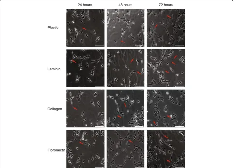 Figure 1 Optimisation of matrices for differentiation of SH-SY5Y cells. SH-SY5Y cells were plated on 6 well plates uncoated (plastic) orcoated with 10 μg/ml of laminin, collagen or fibronectin