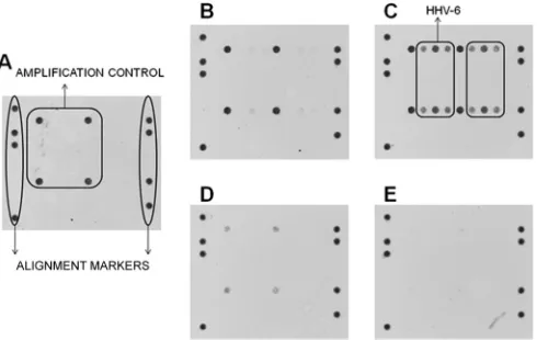 FIG 2 Microarray results for a sample with an HHV-6 viral load above 6 logcopies/ml of blood