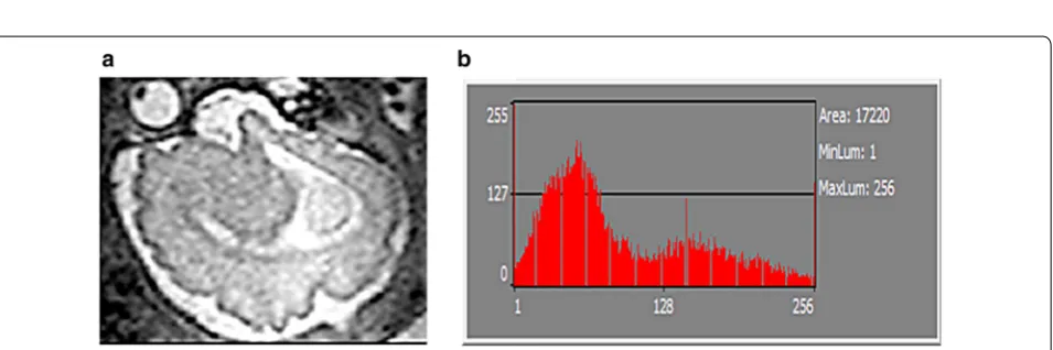 Fig. 3 Varying shades of grey. a Arrange from lighter to darker? b Answers to Puzzle as per measurements from computer vision software