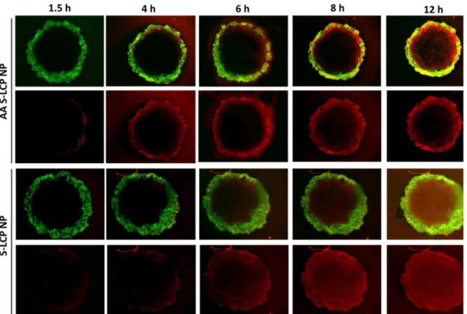Figure 2.12 Time-dependent penetration of DiI labeled S-LCP NPs (+/-AA) in UMUC3 only  spheroid