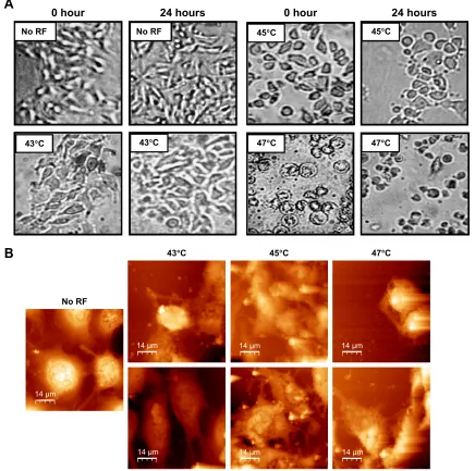 Figure 8 (A) Optical microscopic images (100×) of B16F1 cells at 0 hours and 24 hours after a single cycle of rF-induced dextran-coated lsMO-mediated hyperthermia at different temperatures
