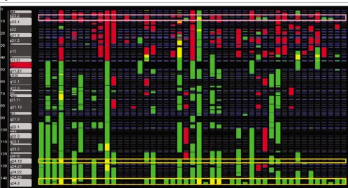 Figure 2Comparative genomic hybridization analyzer view of chromosome 8. Tumors are displayed vertically and bacterial artificial chromosomes (BACS) by Comparative genomic hybridization analyzer view of chromosome 8