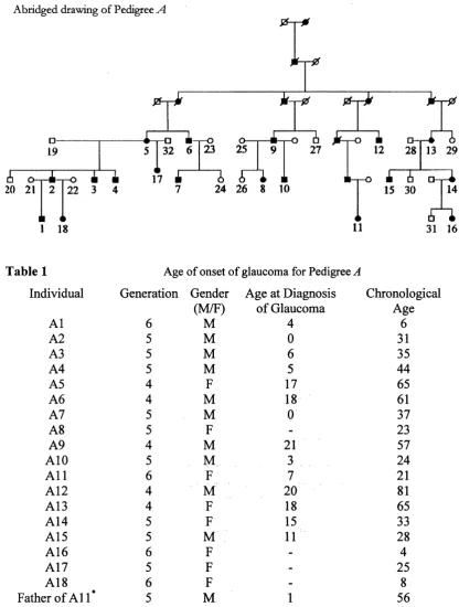 Table 1Age of onset of glaucoma for Pedigree A