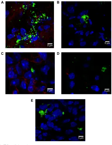 Figure 8 rhodamine 6g/silica particles in mouse tissue.Notes: confocal microscopy of frozen tissue sections is shown: (A) stomach, (B) kidney, (C) lung, (D) brain, and (E) spleen