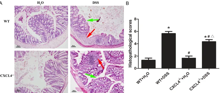 Figure 3. Histopathological changes in the colons of the WT and CXCL4-/- mice challenged with H2O and DSS