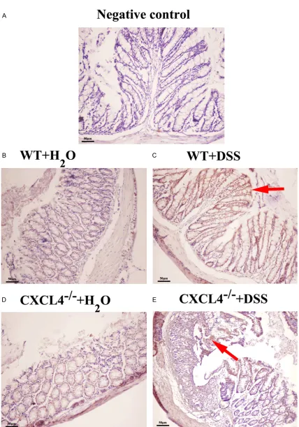 Figure 4. iNOS expression levels inthe WT and CXCL4-/- mice challenged with H2O and DSS