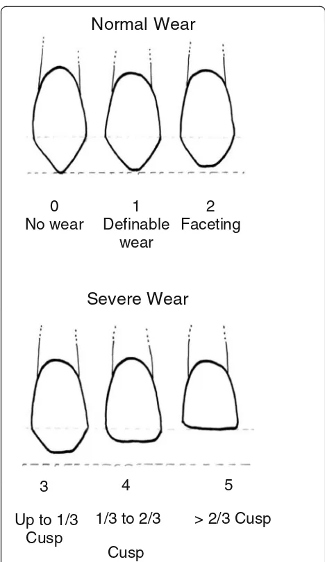 Fig. 2 The Hooper index [16] is used to define normal wear (0–2)and severe wear (3–5) teeth