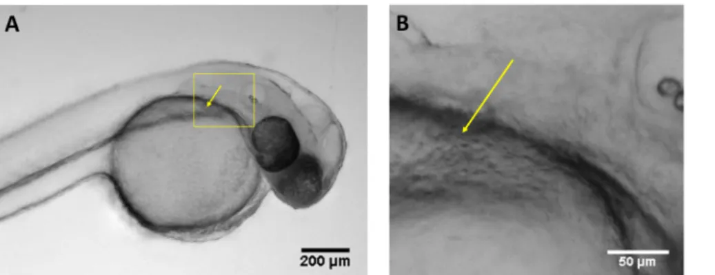 Figure 1: Optimal injection site. (A) Image of larva 48 hpf showing the optimal injection site at the duct of Cuvier (yellow arrow) using a regular stereoscope