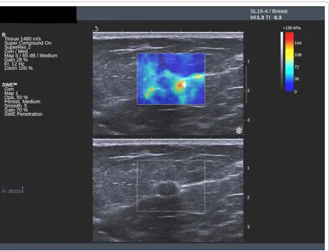 Table 2 Numbers of lesions in each group according to greyscale BI-RADS and shear wave elastography parameters