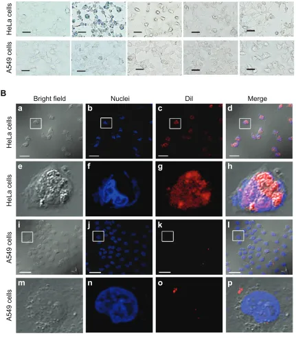 Figure 8 hela cells and a549 cells treated with various contrast agents.Notes: In vitro Prussian blue staining images of controls of hela cells and a549 cells and images of these cells after treatment with FaPlcs/sPIONs, Plcs/sPIONs, sPIONs, and free folic