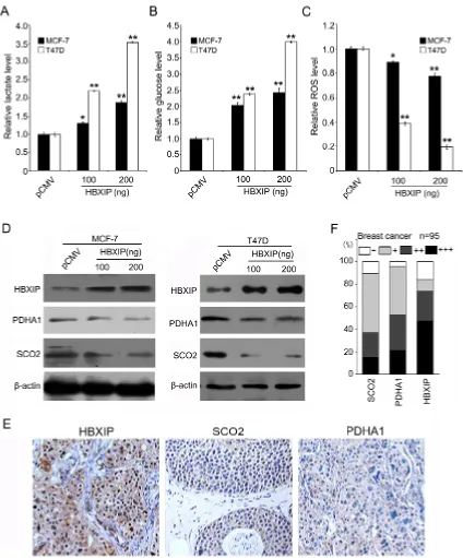Figure 1: HBXIP regulates glucose metabolism reprogramming and downregulates SCO2 and PDHA1 in breast cancer