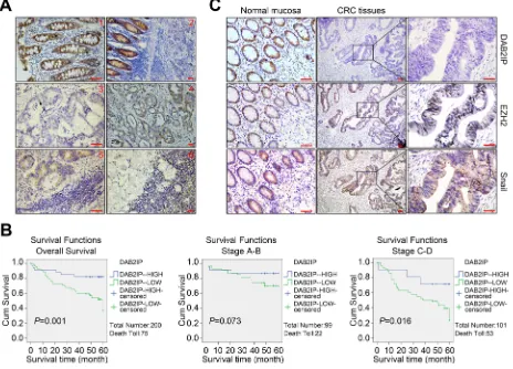 Figure 7: Down-regulation of DAB2IP correlates with Snail and EZH2 in CRC tissues. A1