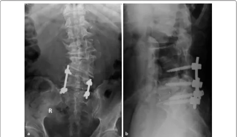 Fig. 5 a, b Postoperative plain X-ray scans, anteroposterior and lateral views, respectively
