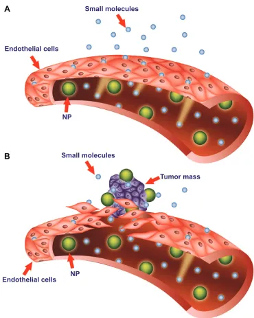 Figure 2 Targeting of nanomedicines by the enhanced permeability and retention (ePR) effect.Notes: Differences between normal (A) and tumor (B) vessels are depicted
