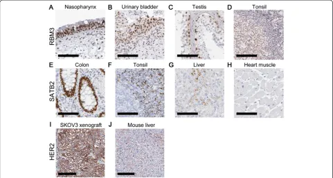 Figure 2 RT-IHC results showing RBM3 expression usingfluorescently labeled secondary antibody