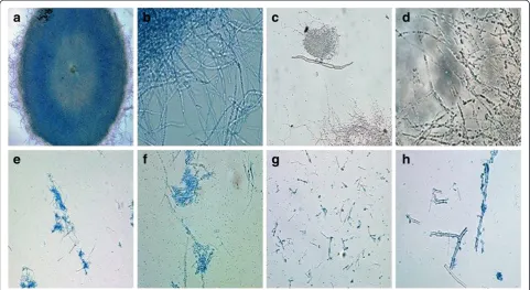 Figure 1 Light microscopy of mycelia from A. oryzae NSK before and after cell disruption