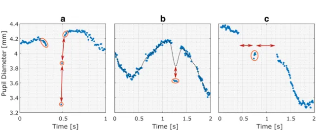 Fig. 2 Raw pupil diameter data showing the different kinds of artifacts that are targeted by the raw data filter presented in this article