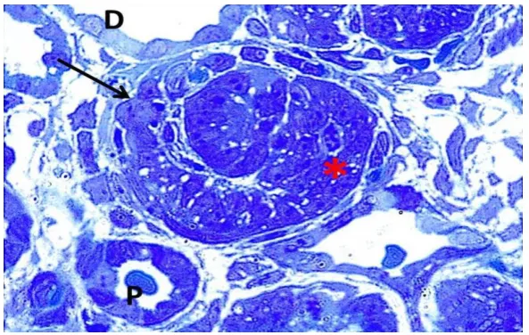 Figure 6: photomicrographs of a semithin sections of the renal cortex of group IIB (PND7) 