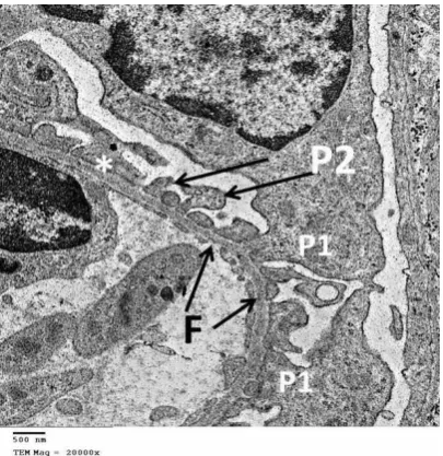 Figure 9: photomicrographs of a higher magnification of the previous figure of group IIA 