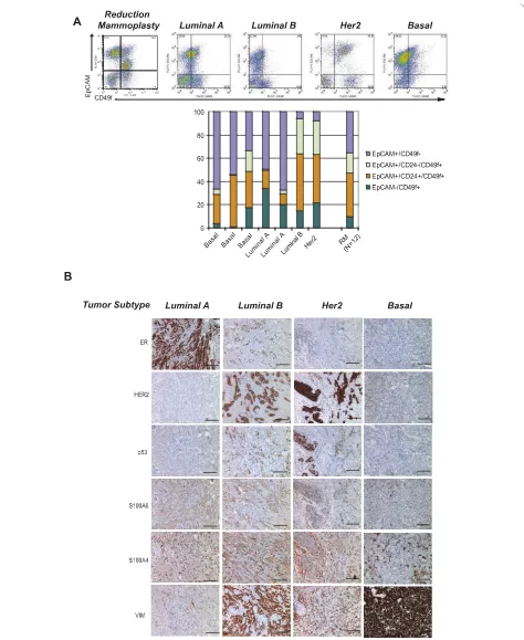 Figure 3 Human breast cancers are heterogeneous tissues comprised of all four cell phenotypes