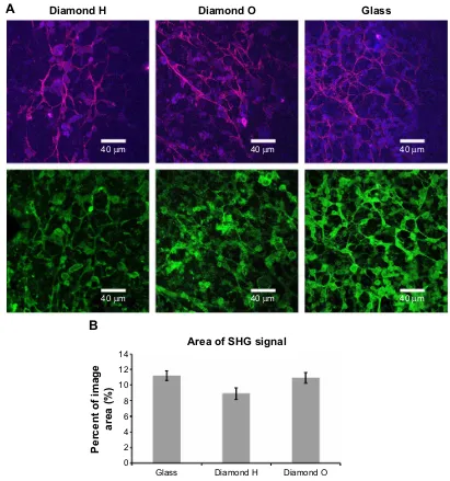 Figure 5 SHG imaging showing collagen fibers in the cell layers on NCD films.Data are expressed as the mean Abbreviations:Notes: SHG signal (magenta), type I collagen immunofluorescence staining (green), and cell autofluorescence (blue) of Saos-2 cells aft