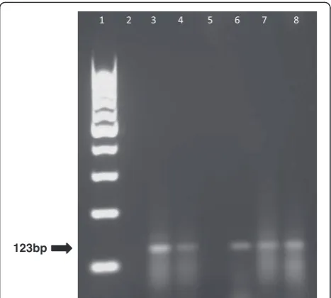 Figure 2 Agarose gel electrophoresis of amplifications performed with protocol 3. Lane 1 = Molecular marker 100 bp, Lane 2 = NegativeControl, Lane 3 = Positive Control, Lane 4 = Sample 8, Lane 5 = Sample 6, Lane 6 = Sample 7, Lane 7 = Sample9, Lane 8 = Sample 5, Lane 9 = Sample10, Lane 10 = Sample 4, Lane 11 = Sample 3, Lane 12 = Sample 1, Lane 13 = Sample 2.